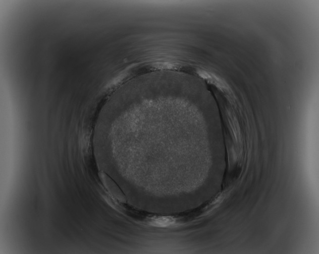 X0000085760409200703231159
