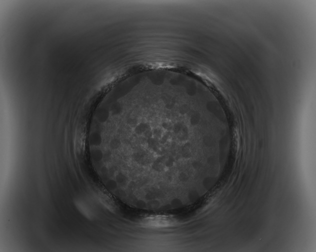 X0000085760499200703231157