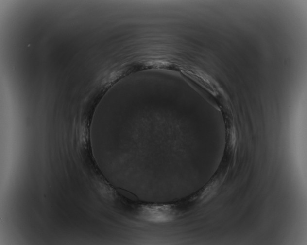 X0000085760517200703231157
