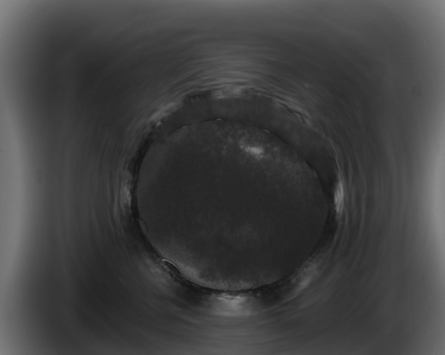 X0000085760570200703231157