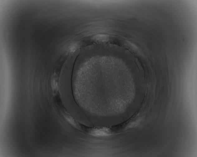 X0000085760576200703231157
