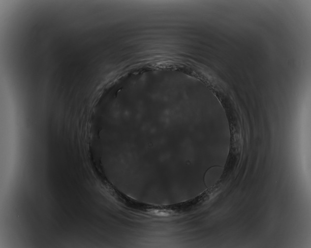 X0000085760654200703231155