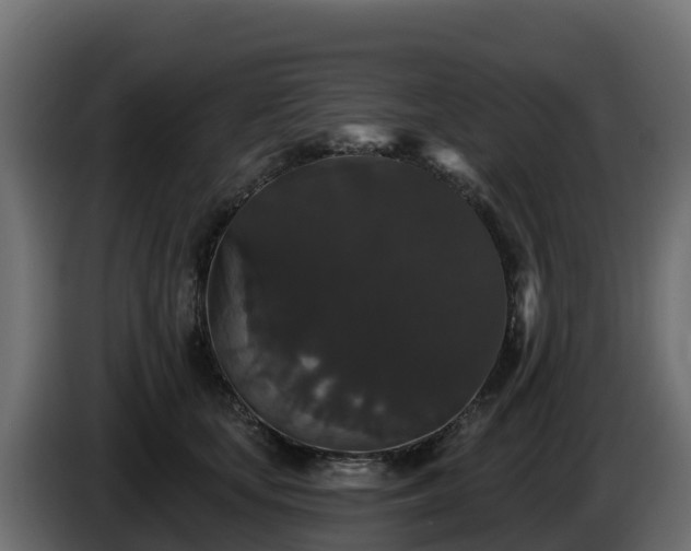 X0000085760659200703231155