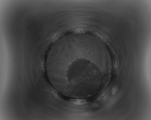 X0000085760663200703231155