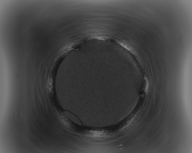 X0000085760693200703231155