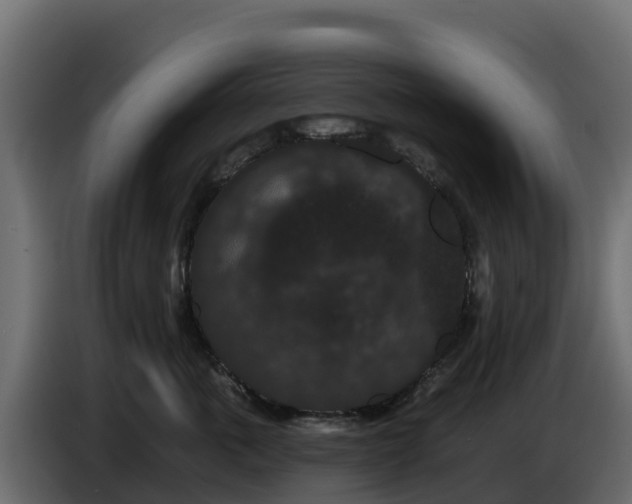X0000085760763200703231154