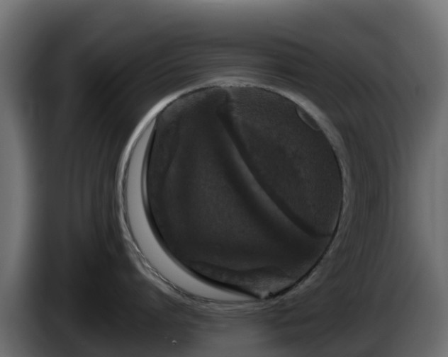 X0000085760864200703231153