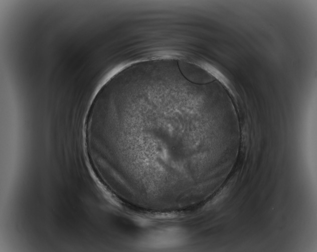 X0000085761047200703231150