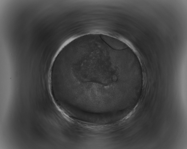X0000085761048200703231150