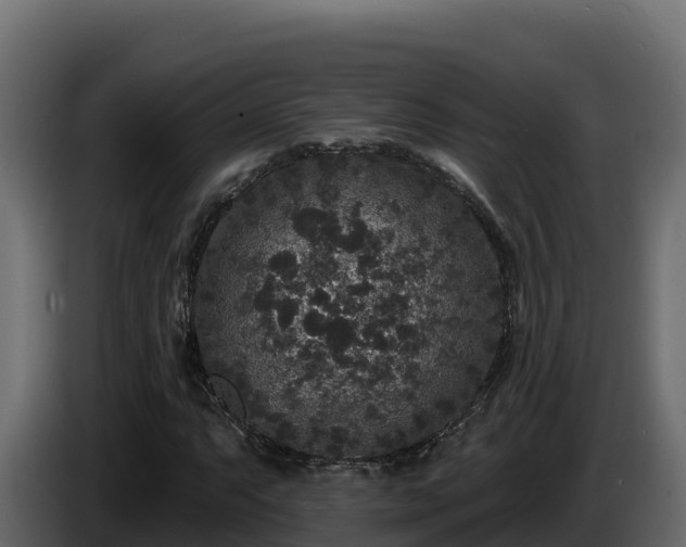 X0000085761063200703231149