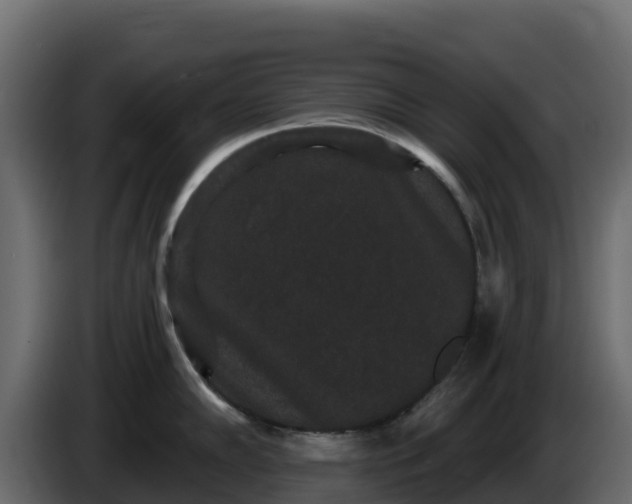 X0000085761102200703231149