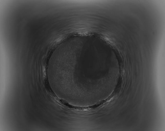 X0000085761106200703231148