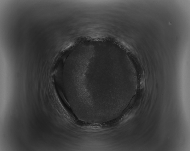 X0000085761156200703231148