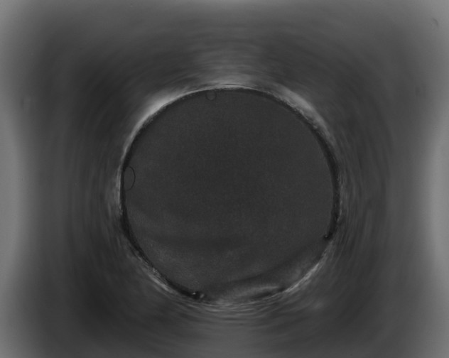X0000085761174200703231148