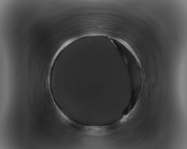 X0000085761197200703231147
