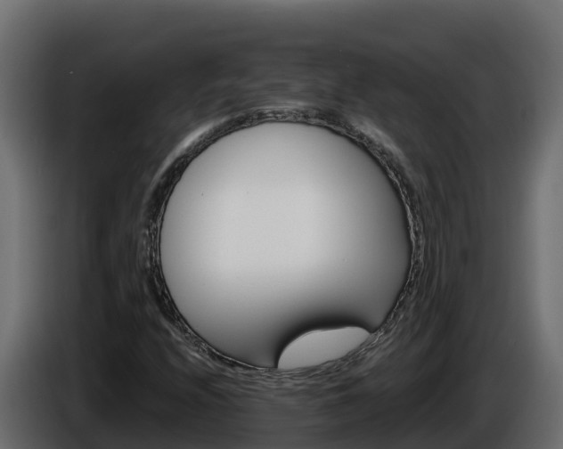 X0000085761208200703231147