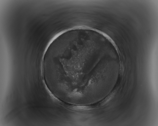 X0000085761295200703231146