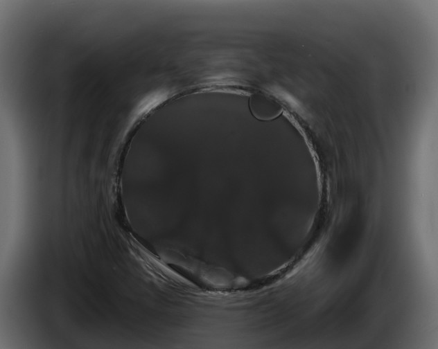X0000085761405200703231144