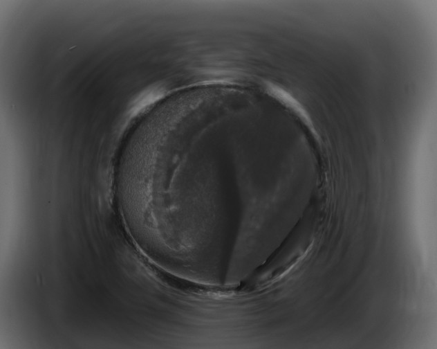 X0000085761411200703231144