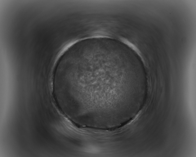 X0000085761415200703231144