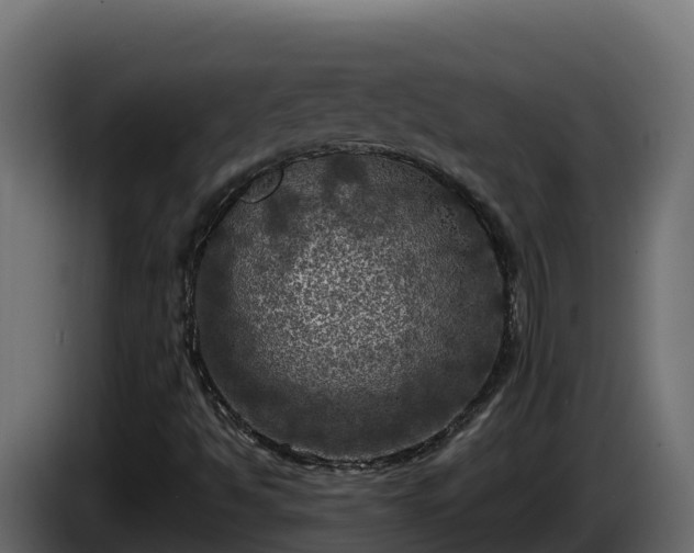 X0000085761494200703231143