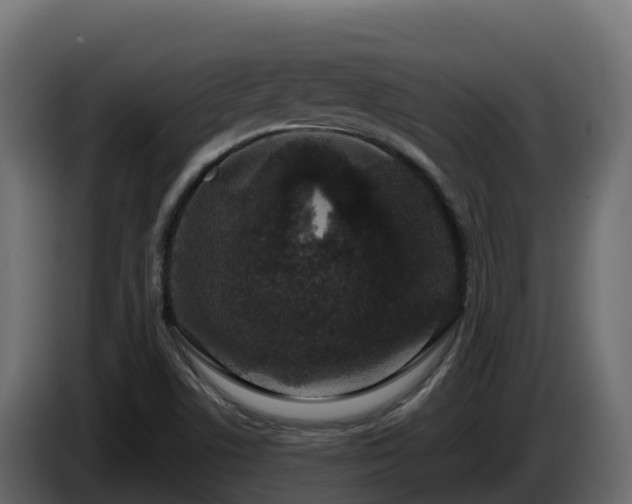 X0000085761506200703231143