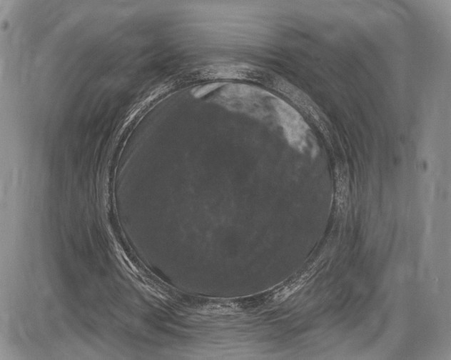 X0000085760386200703301433