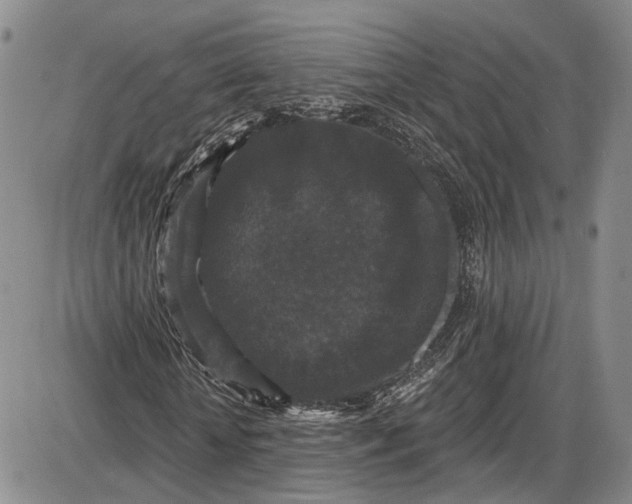 X0000085760818200703301425