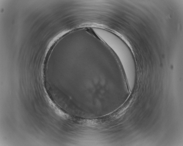 X0000085760995200703301423