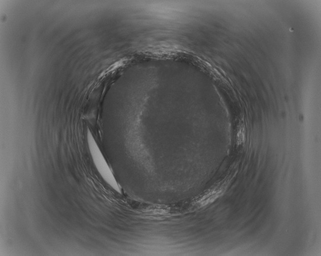 X0000085761156200703301421