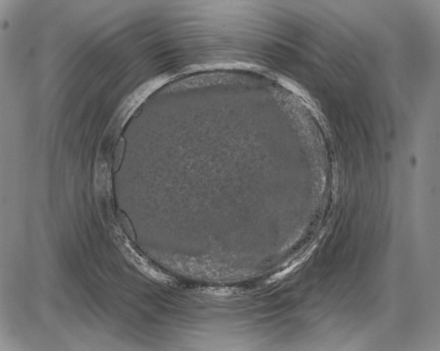X0000085761177200703301420