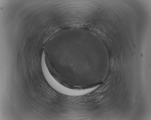 X0000085761202200703301419