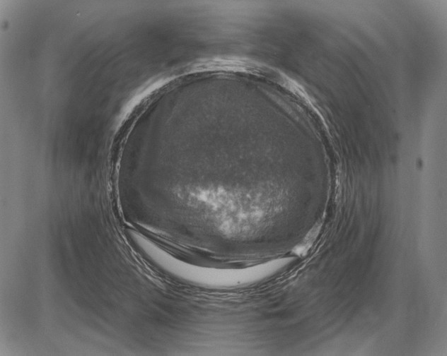 X0000085761312200703301418