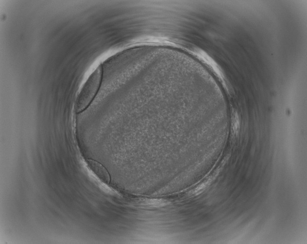 X0000085761382200703301417