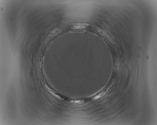 X0000085761441200703301416