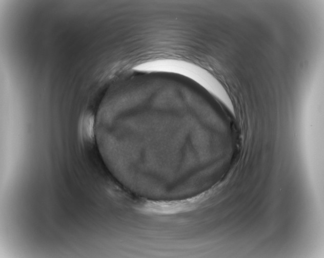 X0000085760041200704091342