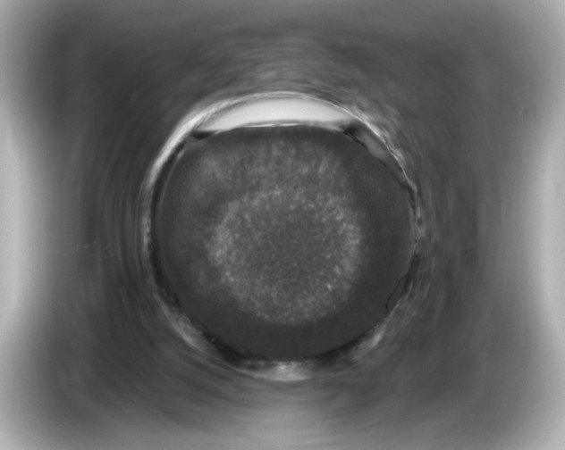 X0000085760056200704091342