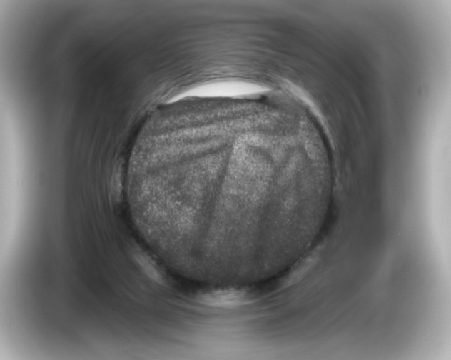 X0000085760065200704091342
