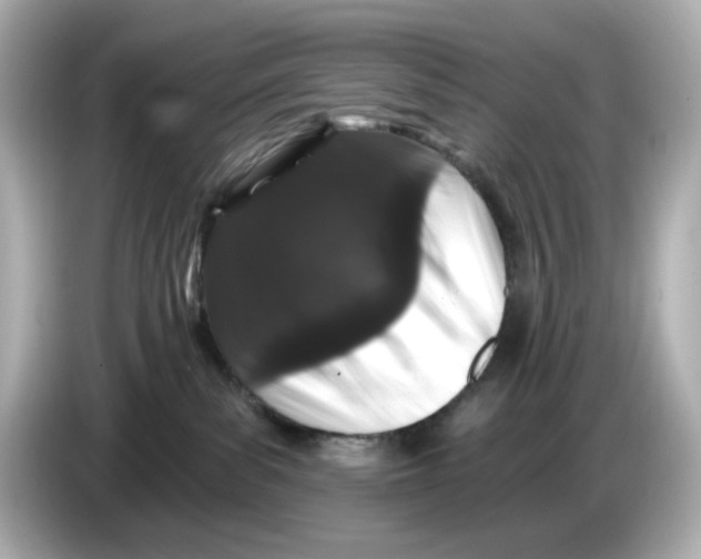 X0000085760139200704091341
