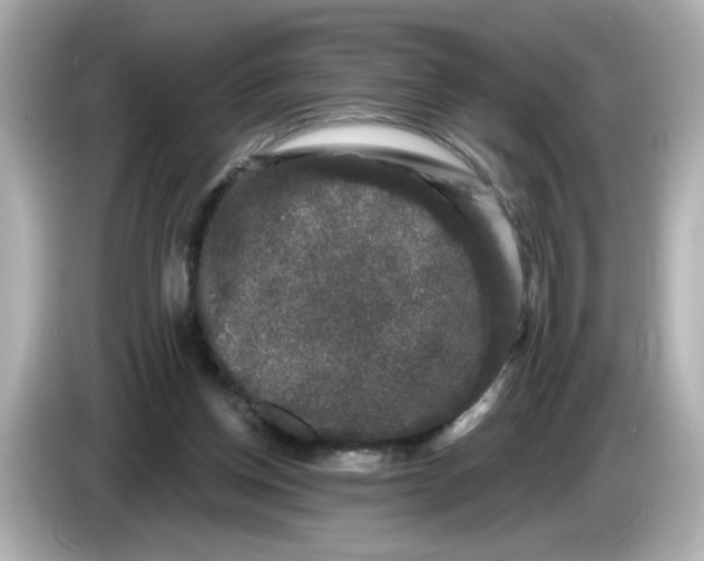 X0000085760158200704091341
