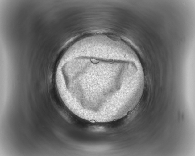X0000085760159200704091341