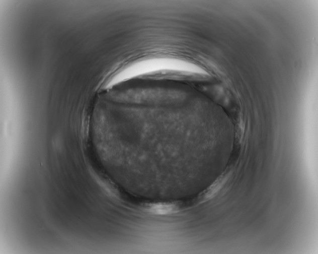 X0000085760168200704091341