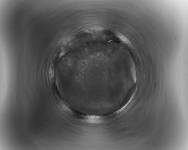 X0000085760192200704091341