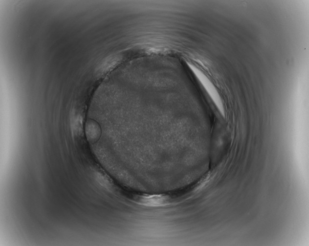 X0000085760269200704091340