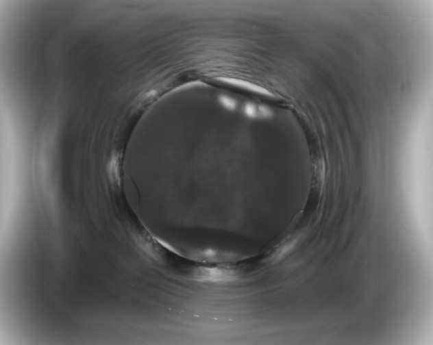 X0000085760286200704091340