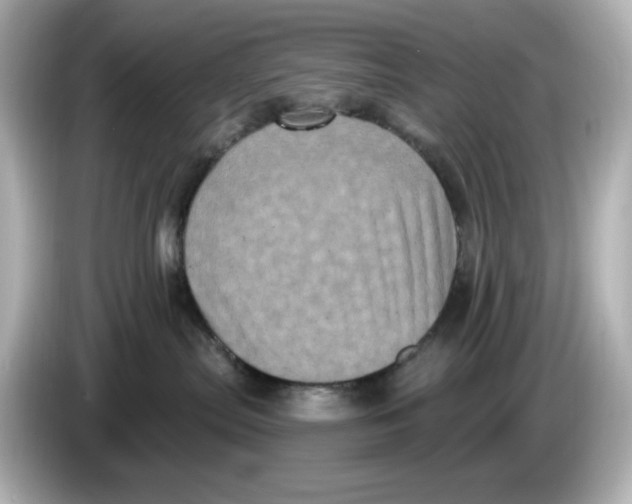 X0000085760287200704091340