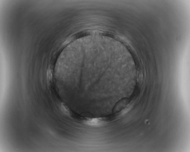 X0000085760382200704091339