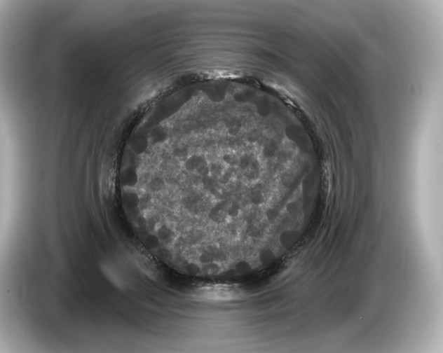 X0000085760499200704091337