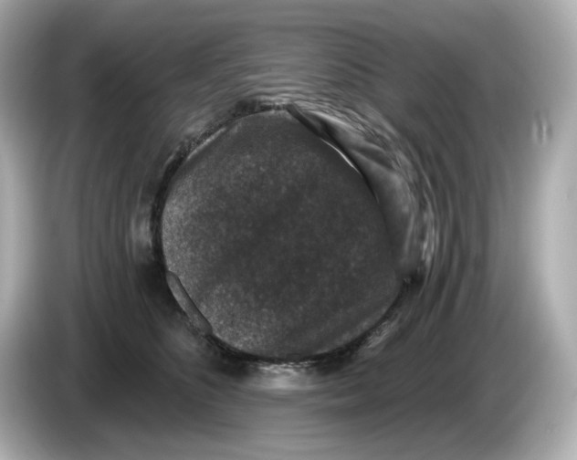 X0000085760516200704091337