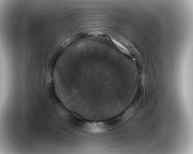 X0000085760517200704091337